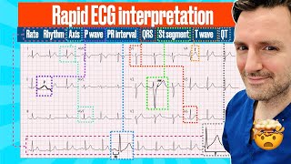 Rapid structured ECG interpretation A visual guide FOR REVISION electrocardiogram [upl. by Nahtanoj]