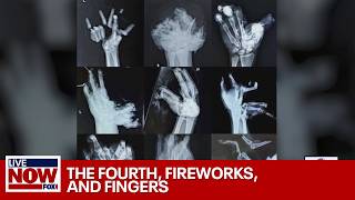 The Fourth fireworks and lost fingers how to stay safe this July  LiveNOW from FOX [upl. by Mazlack362]