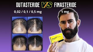 Diferentes Dosis De Dutasteride Vs Finasteride [upl. by Etram]