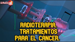 Tratamientos para el Cáncer Radioterapia [upl. by Ratep]