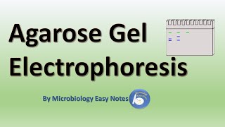 Agarose gel electrophoresis [upl. by Tillio]