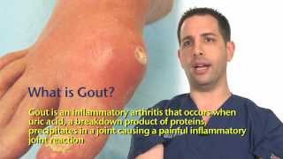 Gout [upl. by Surtemed]