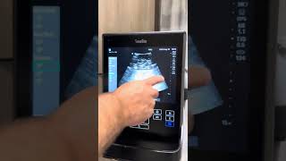 Sonosite s2 bladder scanner function [upl. by Atiuqcaj15]