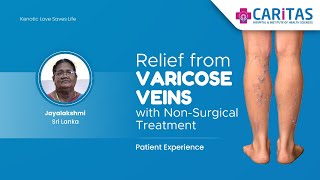 Relief from Varicose Veins with NonSurgical Treatment patienttestimonial srilanka [upl. by Ennairak]