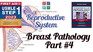 Breast pathologyCancer from Pathoma in urdu Part4 Reproductive system pathUrduHindi [upl. by Idola]