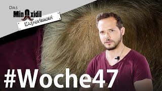 Minoxidil jetzt auch für den Kopf  Das Minoxidil Experiment Woche47 [upl. by Anerual]