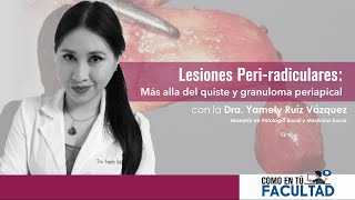 ►Lesiones Periradiculares  Dra Yamely Ruíz Vázquez [upl. by Gnok]