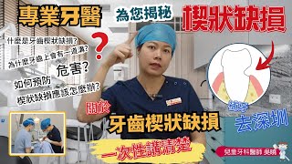 【牙科揭秘：楔狀缺損】專業牙醫為您揭秘楔狀缺損。症狀、病因、危害、預防、治療關於牙齒楔狀缺損，一次性講清楚。科普 北上睇牙 口腔保健 補牙 杜牙根 楔狀缺損 口腔管理 深圳牙醫 [upl. by Rotsen624]