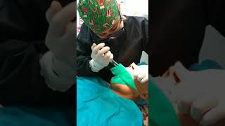 Cómo se realiza un Tratamiento de Conducto o Endodoncia paso a paso [upl. by Rayshell]