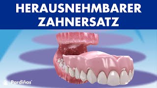 Herausnehmbarer ZAHNERSATZ  Reinigung und Pflege von VOLLPROTHESEN © [upl. by Sanyu]