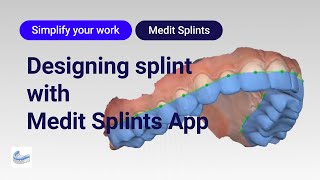 Designing splint with Medit Splints app [upl. by Nayllij332]