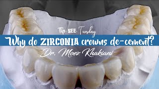 TipSEETuesday ZIRCONIA CROWN DECEMENTATION [upl. by Armilda179]