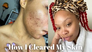 Skincare Routine For Hyperpigmentation amp Dark Spots  CeraVe [upl. by Am918]