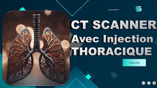 CT Scanner THORACIQUE Avec Injection  Partage de Pratiques [upl. by Revlis991]