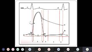 Visioconf  Cardio Valvulopathies partie 12 [upl. by Leay392]