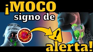 ¡CUIDADO MOCO SIGNO DE ALARMA EN ENFERMEDADES RESPIRATORIAS [upl. by Loria]