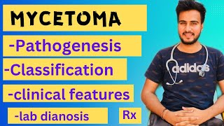 Mycetoma microbiology  Madura footeumycetomaActinomycetomalab diagnosis treatment [upl. by Field]