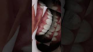 dentistica dentista odontologia dentist [upl. by Hudgens]