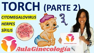 TORCH PARTE 2 CITOMEGALOVIRUS HERPES SÍFILIS Infecciones y embarazo Ginecología y Obstetricia [upl. by Fendig]