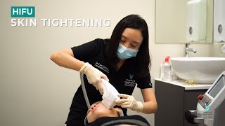 HIFU Face Lifting amp Skin Tightening Singapore 超声刀  550 Nett for 800 Shots [upl. by Coates]