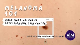 How to Use Mole Mapping to Detect Skin Cancer [upl. by Michaelina781]