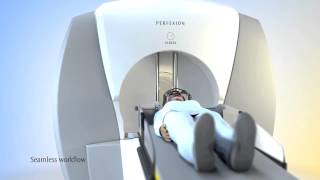 Leksell Gamma Knife Perfexion Stereotactic Radiosurgery [upl. by Bentlee177]