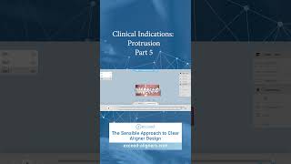 Clinical Indications Protrusion Part 5 [upl. by Kin]