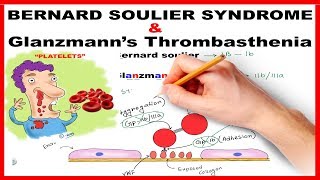 Bernard Soulier Syndrome amp Glanzmanns Thrombasthenia  Mnemonic Series  21 [upl. by Harilda]