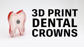 How to 3D print PFM dental crowns  Glidewell Laboratories [upl. by Aerdna447]