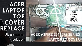 How To replace Top Cover and Hinch Acer Aspire ES1572 series laptop acerlaptop [upl. by Kavanaugh633]