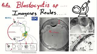 Blastocystis hominis al microscopio óptico [upl. by Odrarej]