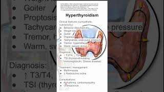 Hyperthyroidism [upl. by Sundberg]