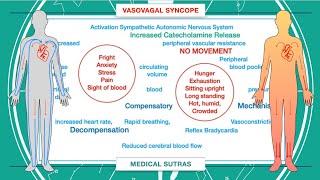 What is syncope and how to manage it [upl. by Bernj]