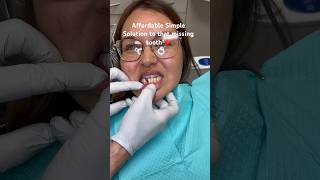 Missing tooth  Implant too pricey  Watch this Simple solution ❤️ [upl. by Joe]