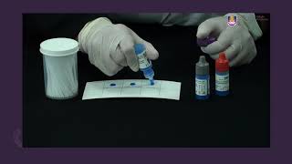 VIDEO ON CRYPTOCOCCAL LATEX AGGLUTINATION TEST [upl. by Gnem]