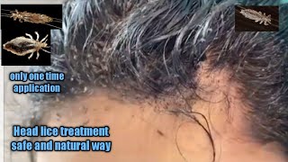 Head lice treatment safe and natural waykuto removalhome remedy remove head lice in a single day [upl. by Urias]