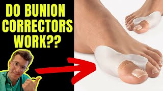 DO BUNION CORRECTORS WORK Doctor explains [upl. by Yleen179]