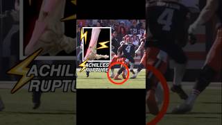 Doctor explains Deshaun Watson Achilles injury in 60 seconds browns nflnews anatomy medical [upl. by Jakoba]