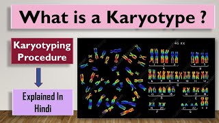 Karyotype  What is a Karyotype and how is it done [upl. by Wycoff]