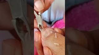 cleaning damage toenail videos pedicure subscribe [upl. by Zetta558]