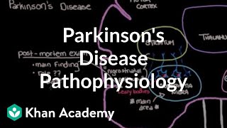 Putting it all together  Pathophysiology of Parkinsons disease  NCLEXRN  Khan Academy [upl. by Moraj]