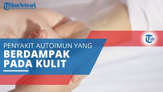 Dermatitis Herpetiformis Penyakit Autoimun yang Berdampak pada Kulit karena Bereaksi dengan Gluten [upl. by Licna]