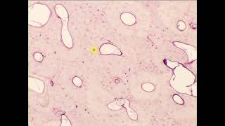 Compact bone XS HampE decalcified [upl. by Uht]