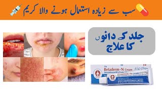 Betaderm N Cream uses in Urdu  Acne Cream Review [upl. by Evey604]