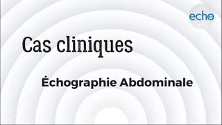 Échographie abdominale [upl. by Artemahs]