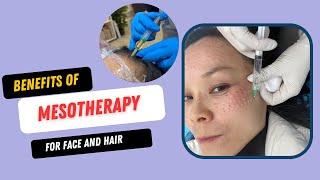 Mesotherapy  Notice facial wrinkles and hair loss when you are 40 [upl. by Yelekalb]