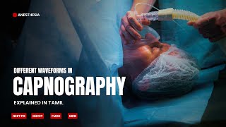 Different waveforms in Capnography  Explained in Tamil  NEET PG  INICET  MRB  FMGE [upl. by Lara]