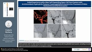 Initial Experience with a New SelfExpanding OpenCell Stent System with Antithrombotic Hydrophilic [upl. by Anohsal]