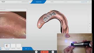 Scanning a Denture with CEREC PrimeScan 511 [upl. by Enelehcim320]