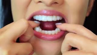 Moldable Thermofitting Teeth Whitening Trays [upl. by Nachison]